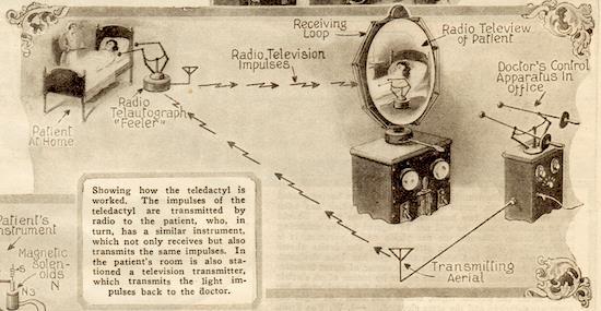 Early Telemedicine The Teledactyl The Teledactyl (Tele, far; Dactyl, finger from the