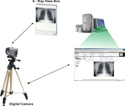 X-Ray Digitizer Innovate with Technology An X-ray digitizer using low cost components, does away with the need for use of an expensive
