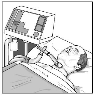 Chronic Critical Illness in Adults Requiring Prolonged Mechanical Ventilation 9 benefits, risks, and burdens for each option. You are encouraged to ask questions.