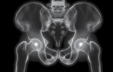 The Rotherham NHS Foundation Trust Total hip replacement Orthopaedic
