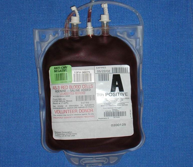 Lack of Standardization Transfusion service operations are quite variable