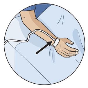 We will give you Heparin through a small needle to help decrease the chance of having blood clots. We will give you an intravenous (IV) line.