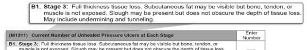 Stage 2 Pressure Ulcer Stage 3 237 238 A stage 2 ulcer also may present as a shiny or dry