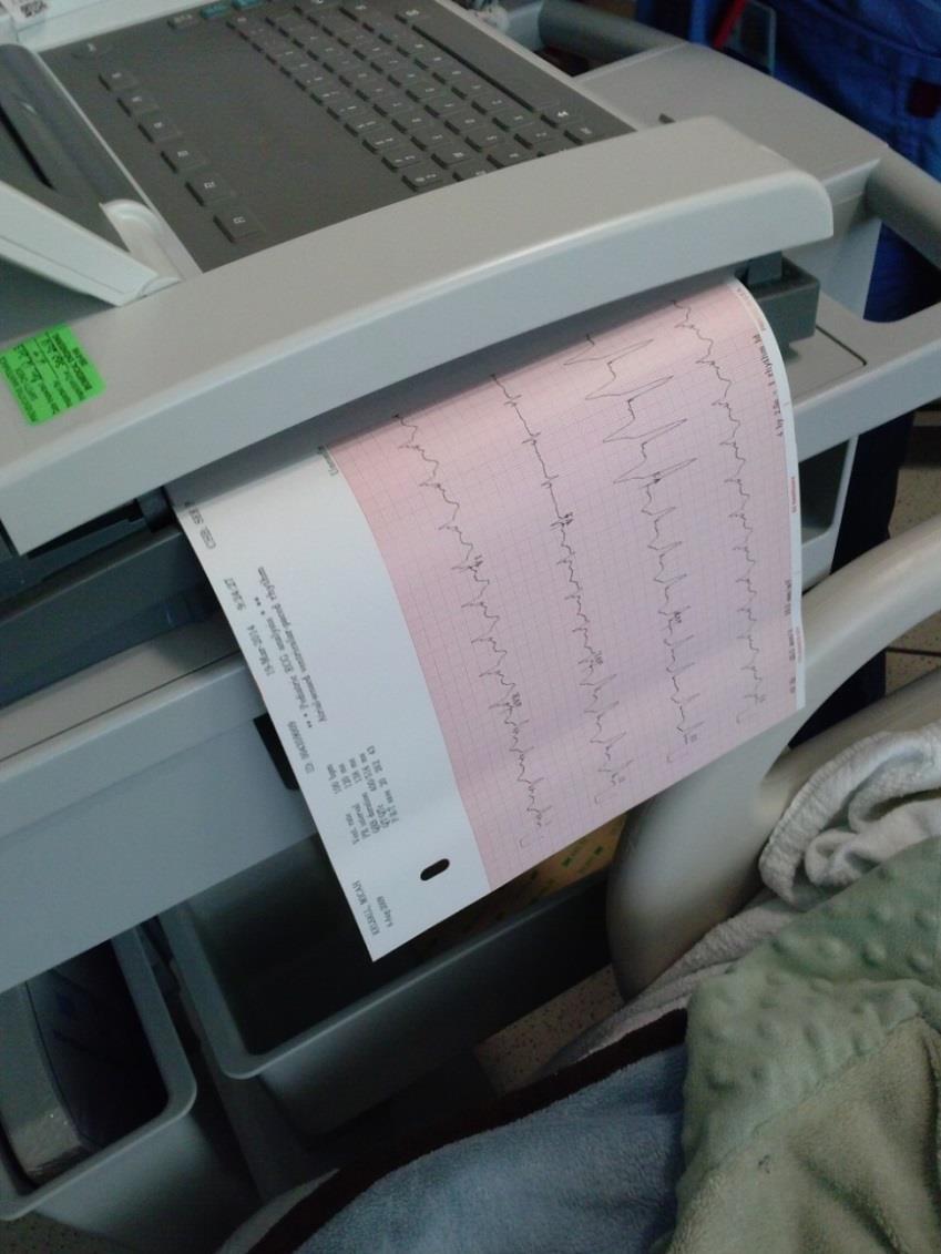 During the EKG, the computer will print out a piece of paper