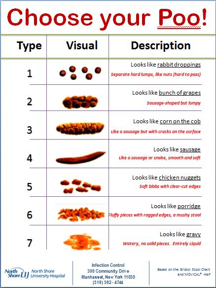 Bristol Stool Chart All types of stools sent to the laboratory for Cdiff testing An increase number of false positive results due to colonization, initiation of