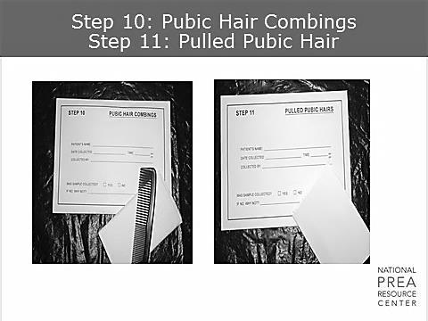 1 min Step 9: Pulled Head Hairs Step 9 Although DNA is much more reliable from good buccal swabs, pulled hair is still recommended for hair comparisons.