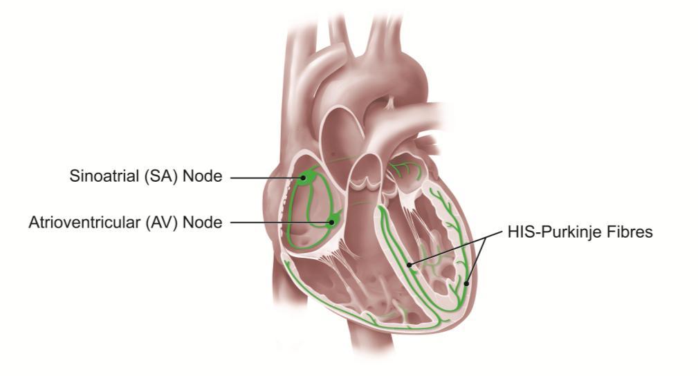 About Pacemakers You have been recommended to have a pacemaker implant to treat your heart rhythm problem.