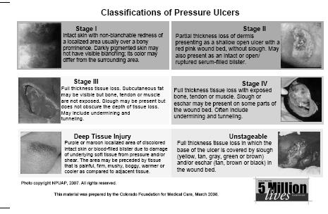 Staging Pressure Ulcers http://www.npuap.org/pr2.htm Deep Tissue Injury (DTI) Stage I Stage II Stage III Stage IV Unstageable?mucosal injury https://www.nursingquality.