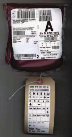 ERROR REPORTS: Human Factors ANNUAL SHOT REPORT 2015 Washed platelets were ordered on the online blood ordering system (OBOS) with the incorrect date required for transfusion therefore platelets were