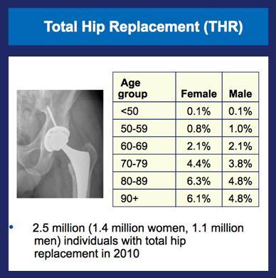 First nationwide prevalence study of hip and knee arthroplasty shows 7.2 million Americans living with implants. Mayo Clinic Clinical Updates. 2014. Web.