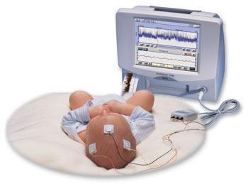 CEREBRAL FUNCTION MONITORING (aeeg). NEONATAL CLINICAL GUIDELINE 1. Aim/Purpose of this Guideline 1.1. To provide guidance on the operation and interpretation of Cerebral Function Monitoring (CFM) in neonates.