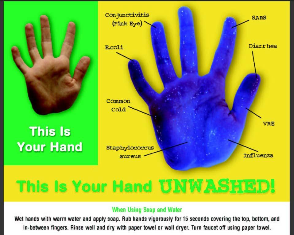 This is Your Hand Unwashed Johns Hopkins www.