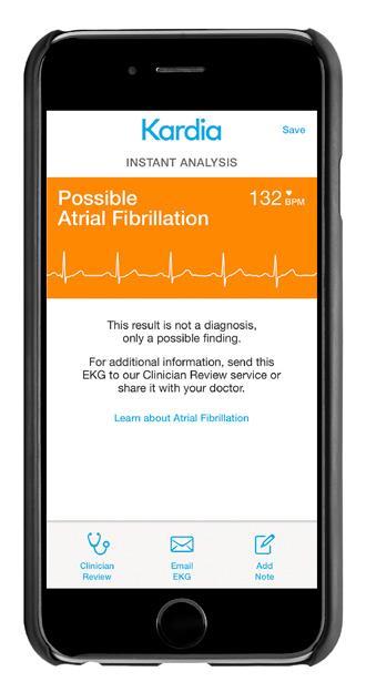 Opportunistic pulse checking #1: Using AliveCor www.
