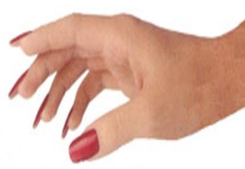 Hand Hygiene Fingernails All employees that have DIRECT patient contact /care should: