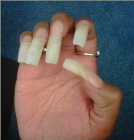 PRESSURE ULCER PREVENTION Keep YOUR nails short!