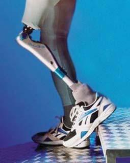 From TENS Units and custom wheelchairs to complex orthotic and prosthetic devices, every product we offer has a twofold purpose: Speedy