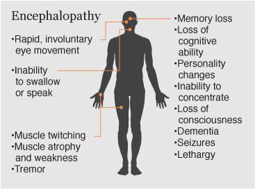 Encephalopathy Encephalopathy is a term for any diffuse disease of the brain that alters brain function or structure.