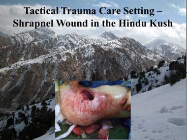 TCCC for All Combatants 1708 Introduction to TCCC Instructor Guide 3 7. Tactical Trauma Care Setting Shrapnel Wound in the Hindu Kush This is a good example of where combat trauma takes place.