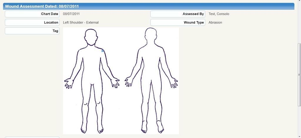 Mini Assessments New Body Site Graphic Image A Body Site Graphic was added the Pain and Wound Assessments.