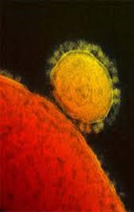 MERS Background Viral respiratory illness coronavirus First identified Saudi Arabian patient, June 2012 May 2014: