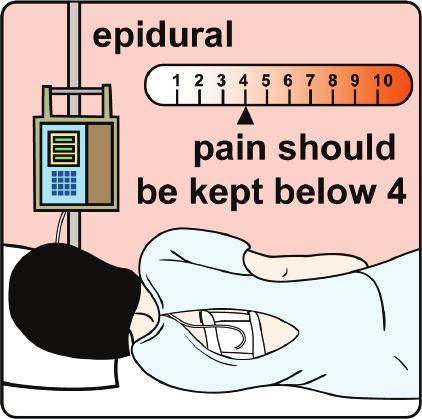 Pain Control After the Surgery Pain relief is important because it helps you: Breathe more easily Move more easily Sleep better Recover faster Do things that are important to you The epidural