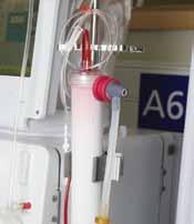 8 Commencing my dialysis Procedure Date: Date: Date: Date: Date: Date: Stop re-circulation Clamp off sodium chloride (saline) Attach