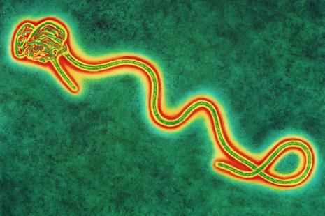 What is Ebola and how does it spread? Ebola is a rare infection spread through direct contact with blood and bodily fluids.