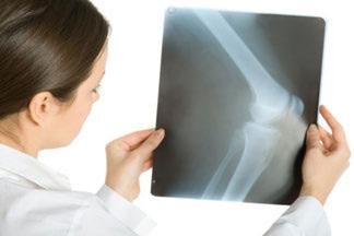 OCCUPATIONAL THERAPY AND PHYSICAL THERAPY Precautions for Knee Replacement It is important to talk to your surgeon about your specific needs prior to surgery to make sure you understand all the