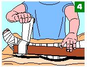 Bind a stick or suitable rigid item over the initial bandage to splint the limb.
