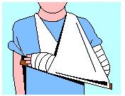First Aid for Bites on the Hand or Forearm 1 As soon as possible, apply a broad pressure bandage from the fingers of the affected arm, bandaging upward as far as possible.