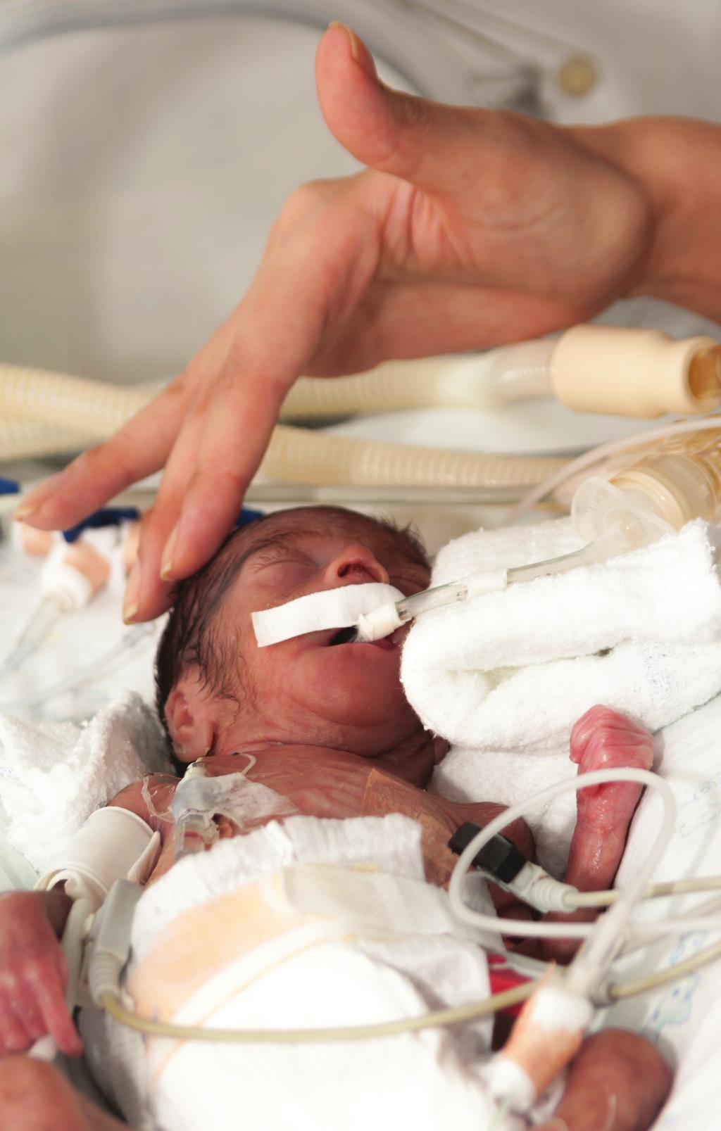 VON 2014 Outcomes VLBW Infants: Helping the Smallest Survive and Thrive Our outcomes and survival rates demonstrate that micro-preemies---a subset of VLBW infants weighing 1,000 grams or less--fare