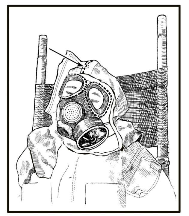 Chapter 5 LITTER PATIENT MASK, PROTECTIVE ENSEMBLE, AND CLOTHING REMOVAL PROCEDURES 5-137. The steps to remove litter patient s protective ensemble are outlined here.