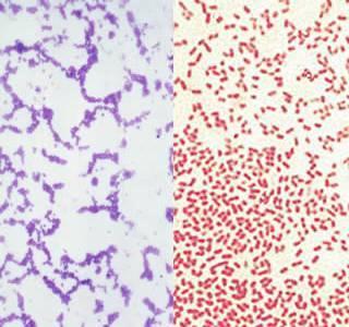 Basics on bacteria Gram Stain Positive (purple) Gram Stain Negative (pink/red) Bacteria have different characteristics that allow us to identify them in the lab Shape, size,
