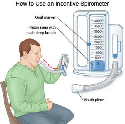 Cough and Deep Breathing Use your breathing machine (Incentive Spirometer) 10 times every hour while you are awake.