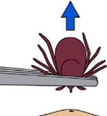 ENVIRONMENTAL MGT OFFICE (Con t) How to remove a tick Use fine-tipped tweezers to grasp the tick as close to the skin's surface as possible. Pull upward with steady, even pressure.