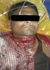 CHHATTISGARH STATE TEAM - BEMETARA DISTRICT EMT PILOT A CASE OF SUICIDE NARENDRA VERMA CHUMMAN When 39 Years old Shankar cut his neck from sharp object.