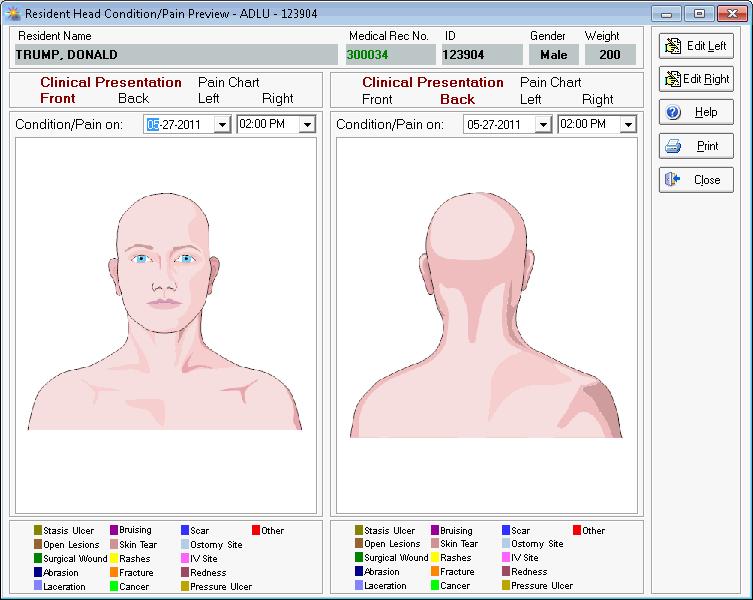 Virtual Picture Chart 1. Select the Care Plan of the Resident you want to view the virtual picture chart of. 2. Access the Care Plan Entry window. 3. Click the Virtual Picture Chart button. 4.