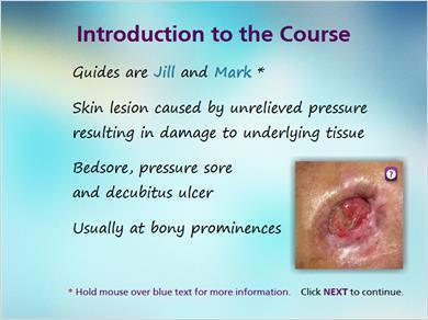 1.2 Introduction JILL: Hi I m Jill and with me is Mark. We will be your guides throughout this online course on pressure ulcers. Are you ready to begin, Mark? MARK: I sure am!