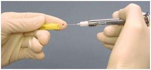 Needlestick Safety and Prevention Act November 2002 Directs OSHA to revise BBP standard to clarify requirement for employers to evaluate safer needles and involve employees in identifying and