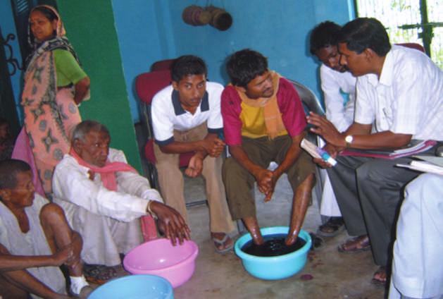 Facilitative Counselling for better patient management in leprosy A sick person needs more than medicament.