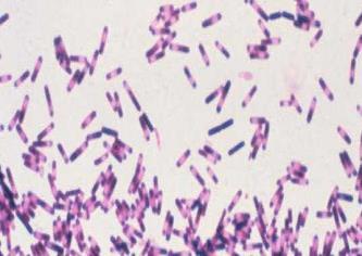 Clostridium difficile Gram positive bacillus under microscope Cannot multiple when oxygen is in the environment
