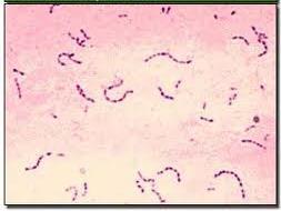 (C. diff ) is a Gram positive rod Gram negative Most are baccili, rod-shaped