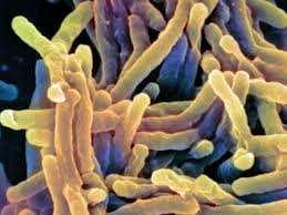 Controlling Tuberculosis Transmission The following groups of controls are used to