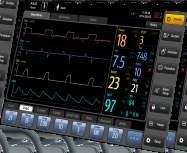 The data suggests that SV300 ventilators require