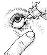 HOW TO PUT IN EYE DROPS Always wash your hands with soap and water before and after. Place the cap on a clean tissue.