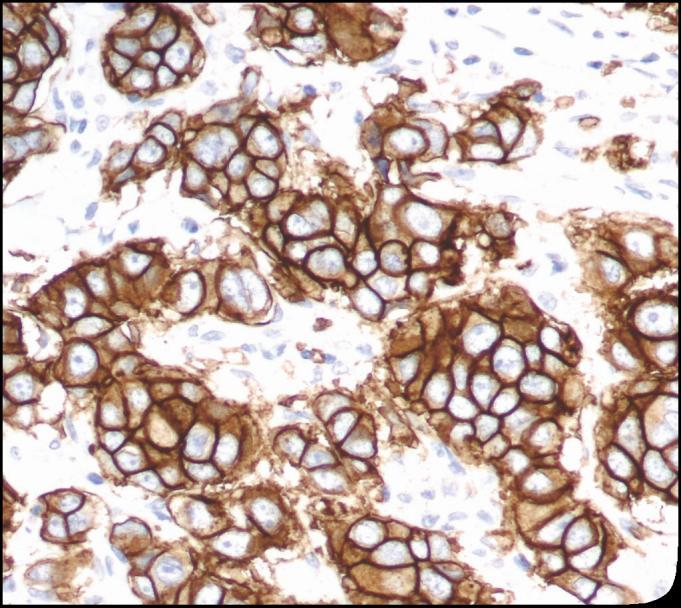 Reproducibility Accuracy Delivering diagnostic confidence in HER2 IHC