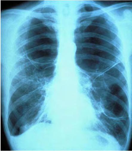 December 2016 25 Diagnostic Chest X-rays Diagnostic chest x-rays are radiologic studies for the purpose of diagnosis of illness or condition which manifest symptoms within