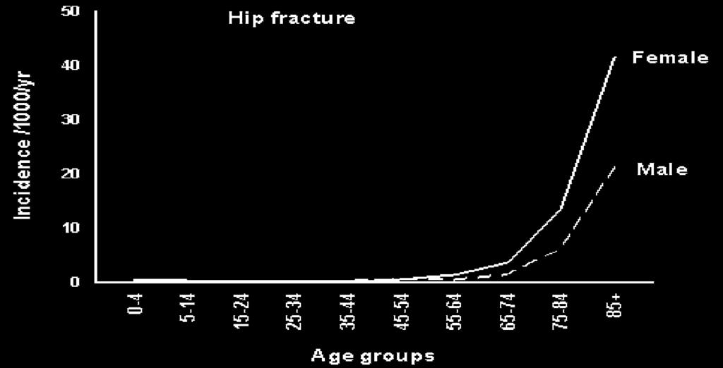 4.1 Prevention This age and sex distribution is mirrored in the incidence of hip fracture, which again is highest in the female population.