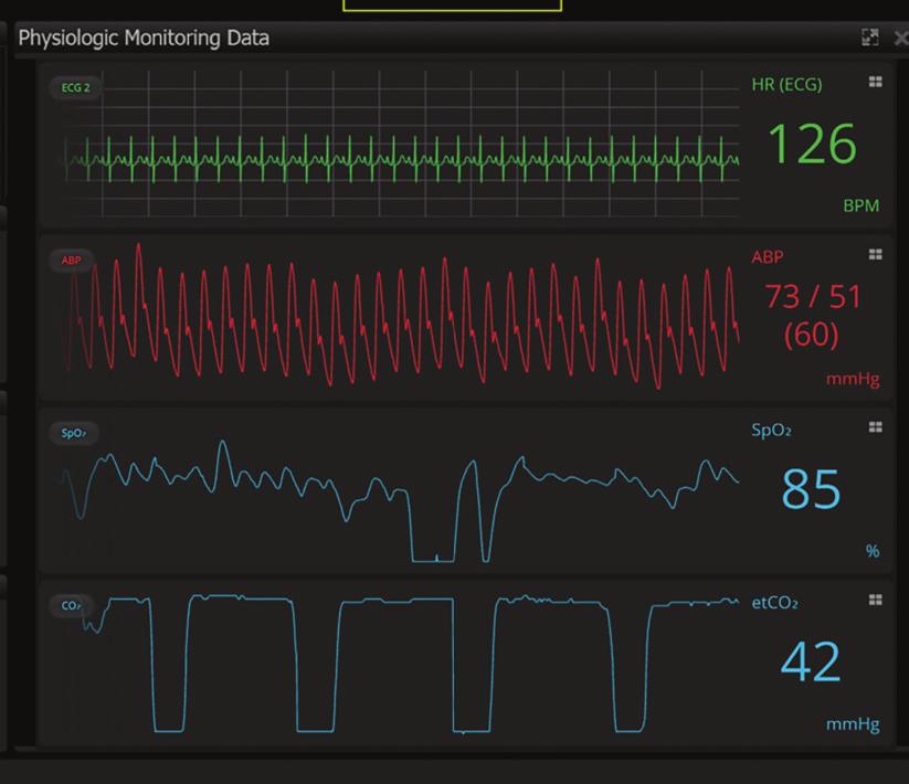 Figure 2. View of physiologic monitoring data from the electronic health record.