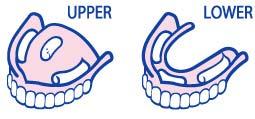 Put in resident s dentures Use adhesive to keep in place Eating in a chair or wheelchair is best If eating in bed, put